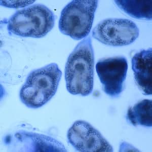 Echinococcus_hydatidsand_B.jpg Figure D