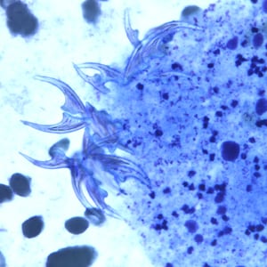 EchinococcusCellNetix_D.jpg Figure D: Higher magnification of the image in Figure C, showing a close-up of the hooklets.