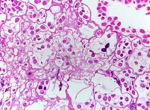 Em_cyst1 Figure C
