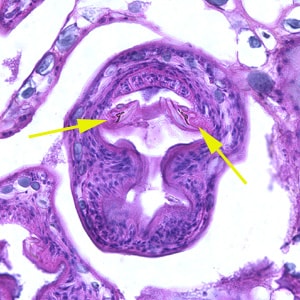 Emultilocularis_liver_BAM2.jpg Figure B: Higher magnification (400x) of the specimen in Figure A. Notice a pair of refractile hooks (yellow arrows). Cestode hooks do not stain with H&E but may be visible with proper adjustment of the microscope.