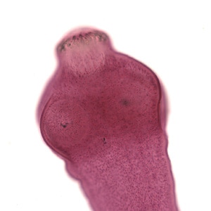 Egranulosus_scolex_stained_BAM.jpg Figure B
