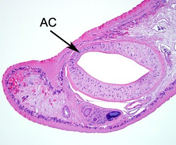 Echinostoma_tissue_BAM2.jpg Figure B:Higher magnification of the anterior end of the specimen in Figure A. Notice the acetabulum (ventral sucker, AC).