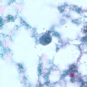 E_gingivalis_troph_BAM4.jpg Figure D