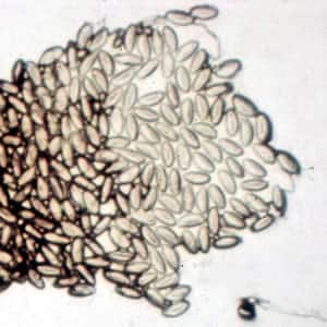 Evermicularis_worm4_HB.jpg Figure A: Eggs of <em>E. vermicularis</em> in a cellulose-tape preparation.