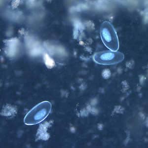 Evermicularis_egg_UVa.jpg Figure E: Eggs of <em>E. vermicularis</em> viewed under UV microscopy.