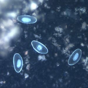 Evermicularis_egg_UVb.jpg Figure F: Eggs of <em>E. vermicularis</em> viewed under UV microscopy.