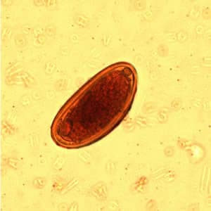 Evermicularis_egg_wtmt.jpg Figure C: Egg of <em>E. vermicularis</em> in an iodine-stained wet mount from a formalin concentrate. Image contributed by the Kansas State Public Health Laboratory.