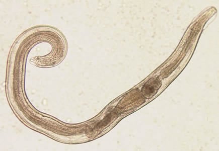 Evermicularis_adult2_Norway.jpg Figure A: Adult male of <em>E. vermicularis</em> from a formalin-ethyl acetate (FEA) concentrated stool smear. The worm measured 1.4 mm in length. Image contributed by the Centre for Tropical Medicine and Imported Infectious Diseases, Bergen, Norway.
