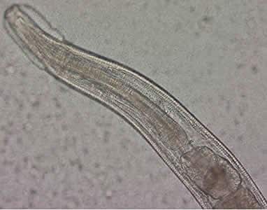 Evermicularis_adult_anterior_Norway.jpg Figure B: Close-up of the anterior end of the worm in Figure A. The esophagus, divided into muscular and bulbous portions and separated by a short, narrow isthmus, is visible in the image, as are the cephalic expansions.
