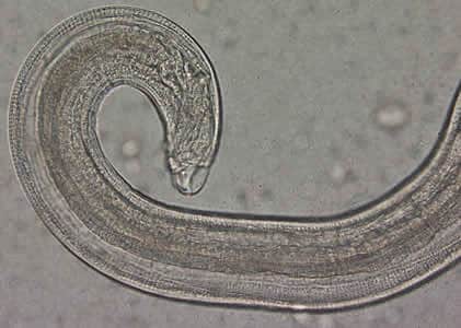Evermicularis_adult_posterior_Norway.jpg Figure C: Close-up of the posterior end of the worm in Figure A. Note the blunt end. The spicule is withdrawn into the worm in this specimen.