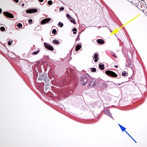 Evermicularis_Sheboygan_cross.jpg Figure C: Cross section of an adult female <em>E. vermicularis</em> stained with H&E, recovered during a colonoscopy. Note the prominent alae (blue arrow) and the presence of eggs (yellow arrow). Image contributed by Sheboygan Memorial Hospital, Wisconsin.