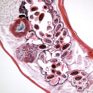 Evermicularis_Sheboygan_longitud.jpg Figure D: Longitudinal section of an adult female <em>E. vermicularis</em> from the same specimen as Figure C. Note the presence of many eggs.