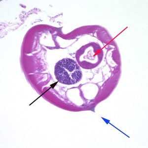 Evermicularis_worm4_HB.jpg Figure A: Cross-section of a male <em>E. vermicularis</em> from tissue, stained with H&E. Notice the presence of the alae (blue arrow), intestine (red arrow) and testis (black arrow).