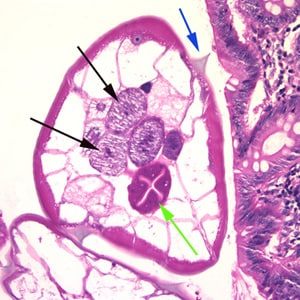 Evermicularis_worm5_HB.jpg Figure B: Cross-section of an adult female <em>E. vermicularis</em> from the same specimen shown in Figure A. Note the presence of the alae (blue arrow), intestine (green arrow) and ovaries (black arrows).