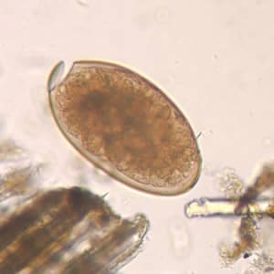 Figure A: Egg of <em>F. hepatica</em> in an unstained wet mount, taken at 400x magnification.