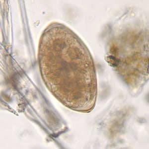Figure B: Egg of <em>F. hepatica</em> in an unstained wet mount, taken at 400x magnification.