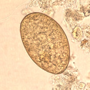 Figure C: Egg of <em>F. buski</em> in unstained wet mounts.