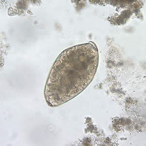 Figure D: Egg of <em>F. buski</em> in an unstained wet mount of stool.