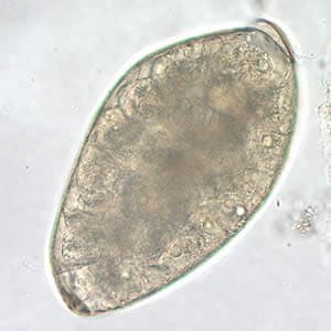 Figure E: Higher magnification (400x) of the egg in Figure D.
