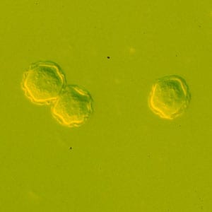 Acanthamoeba_cysts_culture_Vish1.jpg Figure A: Cysts of <em>Acanthamoeba</em> spp. in culture.