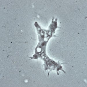 Acanthamoeba_troph_culture_Vish1.jpg Figure A: Trophozoite of <em>Acanthamoeba</em> sp. from culture. Notice the slender, spine-like acanthapodia.