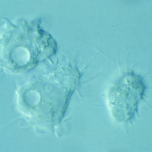 Acanthamoeba_troph_culture_Vish2.jpg Figure B: Trophozoites of <em>Acanthamoeba</em> sp. from culture. Notice the slender, spine-like acanthapodia.