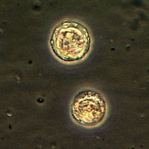 Balamuthia_cyst_Vish1.jpg Figure A: Cysts of <em>B. mandrillaris</em>.