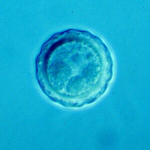 Balamuthia_cyst_Vish3.jpg Figure C: Cyst of <em>B. mandrillaris</em>.