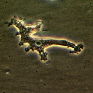 Balamuthia_troph_Vish1.jpg Figure A: Trophozoite of <em>B. mandrillaris</em> in culture.