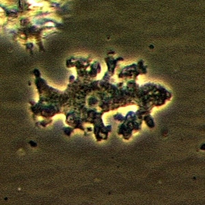 Balamuthia_troph_Vish2.jpg Figure C: Trophozoite of <em>B. mandrillaris</em> in culture.