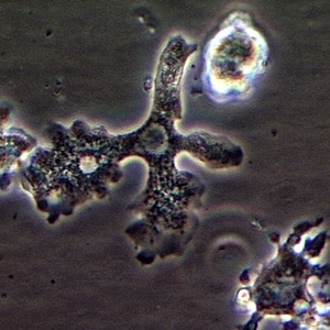 Balamuthia_troph_Vish4.jpg Figure B: Trophozoite of <em>B. mandrillaris</em> in culture.