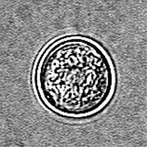 N_fowleri_cyst_Vish1.jpg Figure A: Cyst of <em>N. fowleri</em> in culture.