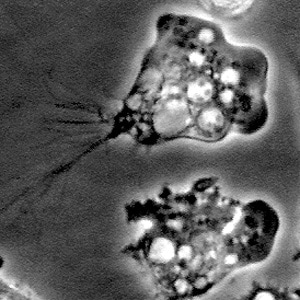 N_fowleri_troph_Vish1.jpg Figure B: Trophozoites of <em>N. fowleri</em> in culture.