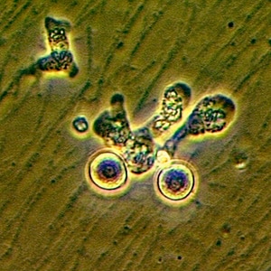 N_fowleri_troph_Vish2.jpg Figure A: Trophozoite of <em>N. fowleri</em> in culture.