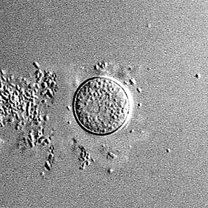 Sappinia_cyst_Vish1.jpg Figure A: Cyst of <em>Sappinia</em> sp. in culture, viewed under differential interference contrast (DIC) microscopy.