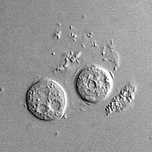 Sappinia_cyst_Vish2.jpg Figure B: Cysts of <em>Sappinia</em> sp. in culture, viewed under differential interference contrast (DIC) microscopy.