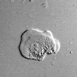 Sappinia_troph_Vish1.jpg Figure C: Trophozoite of <em>Sappinia</em> sp. in culture, viewed under DIC microscopy.