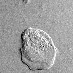 Sappinia_troph_Vish2.jpg Figure E: Trophozoite of <em>Sappinia</em> sp. viewed under DIC microscopy.