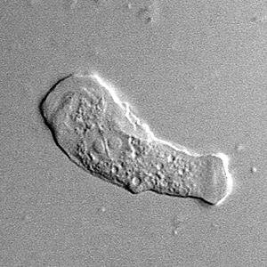 Sappinia_troph_Vish3.jpg Figure D: Trophozoite of <em>Sappinia</em> sp. in culture, viewed under DIC microscopy.