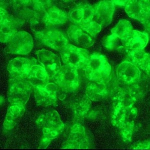 Acanthamoeba_IFA_Vish1_1000x.jpg Figure B: IIF of <em>Acanthamoeba</em> sp. viewed under UV microscopy. This image was taken at 1000x oil magnification.