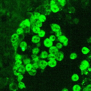 Acanthamoeba_IFA_Vish2_400x.jpg Figure A: IIF of <em>Acanthamoeba</em> sp. viewed under UV microscopy. This image was taken at 400x magnification.