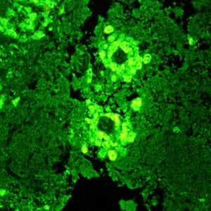 Balamuthia_IIF_Vish1.jpg Figure C: IIF of <em>Balamuthia mandrillaris</em> in brain tissue, viewed under UV microscopy.