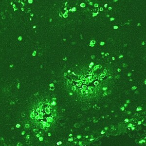 N_fowleri_IIF_Vish1.jpg Figure D: IIF of <em>Naegleria fowleri</em> in brain tissue, viewed under UV microscopy. This image was taken at 200x magnification.