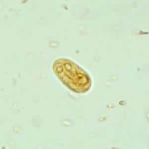 Giardia_cyst_wtmt.jpg Figure A: <em>G. duodenalis cyst</em> in a wet mount stained with iodine.
