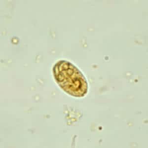 Giardia_cyst_wtmt2.jpg Figure B: <em>G. duodenalis cyst</em> in a wet mount stained with iodine.