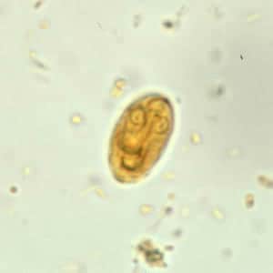 Giardia_cyst_wtmt3.jpg Figure C: <em>G. duodenalis cyst</em> in a wet mount stained with iodine.