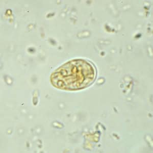Giardia_cyst_wtmt4.jpg Figure D: <em>G. duodenalis cyst</em> in a wet mount stained with iodine.