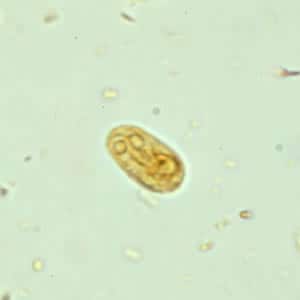 Giardia_cyst_wtmt5.jpg Figure E: <em>G. duodenalis cyst</em> in a wet mount stained with iodine.