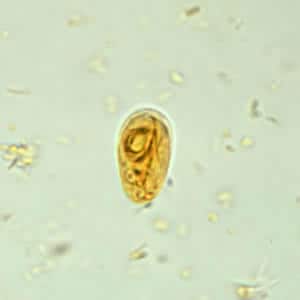 Giardia_cyst_wtmt6.jpg Figure F: <em>G. duodenalis cyst</em> in a wet mount stained with iodine.