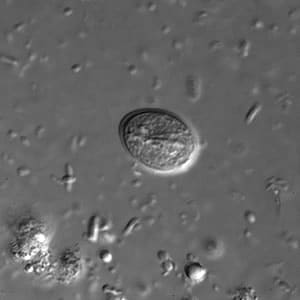 Giardia_cyst_dic.jpg Figure A: <em>G. duodenalis cyst</em> in a wet mount under differential interference contrast (DIC) microscopy. Image taken at 1000× magnification.